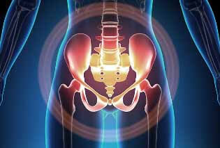 Douleur avec varices du petit bassin. 